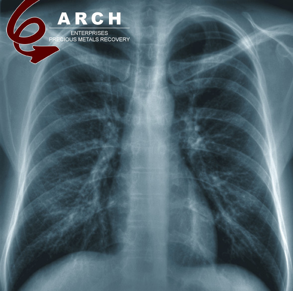 Arch X Ray Refining